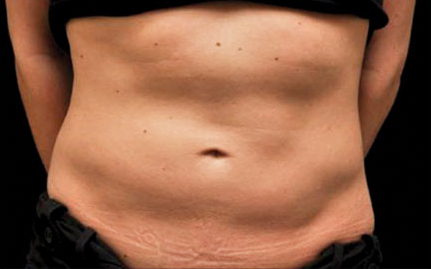 208 Before Image