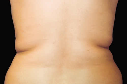 225 Before Image