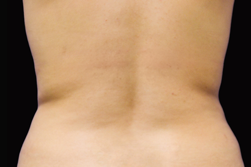 225 After Image