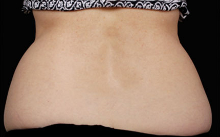 226 Before Image