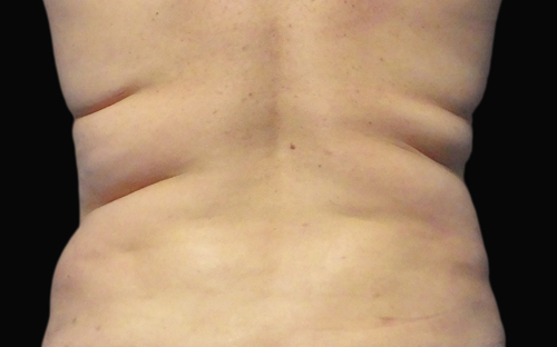 254 Before Image