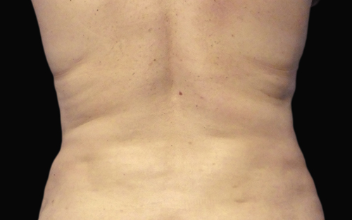 254 After Image