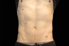 63 Before Image