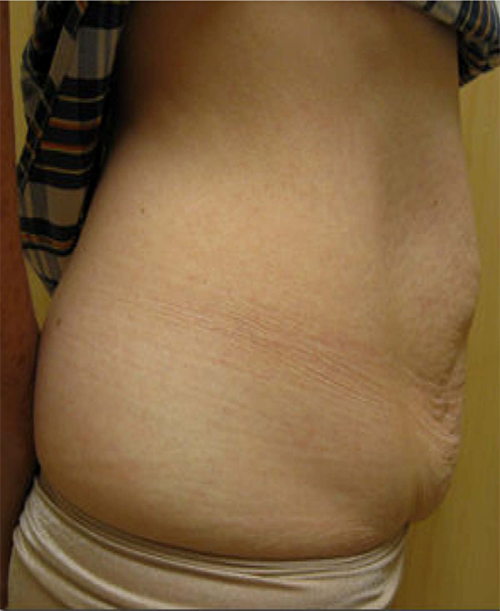 97 Before Image