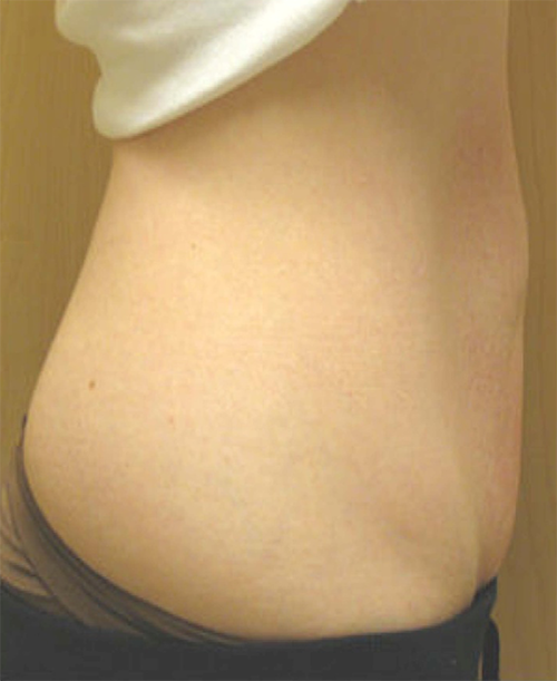 97 After Image