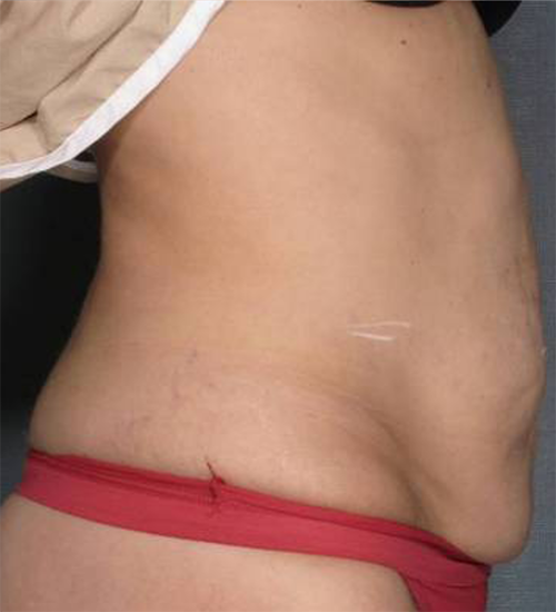 95 Before Image
