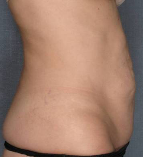95 After Image