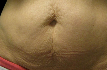 2723 Before Image