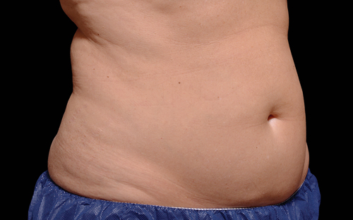 218 Before Image