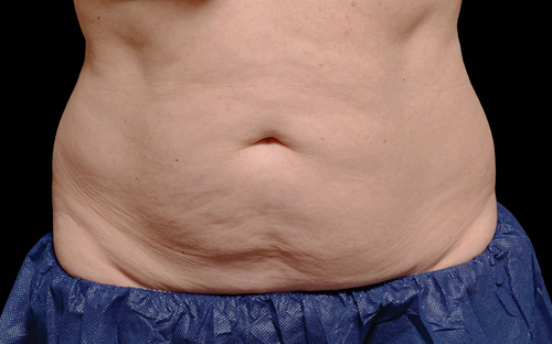 222 Before Image