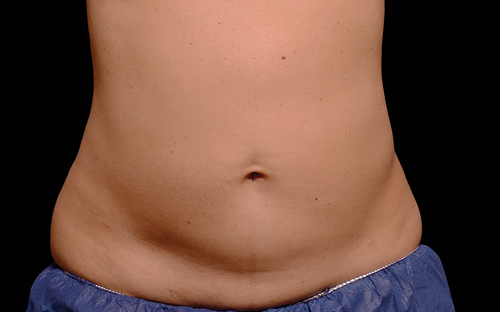 224 Before Image
