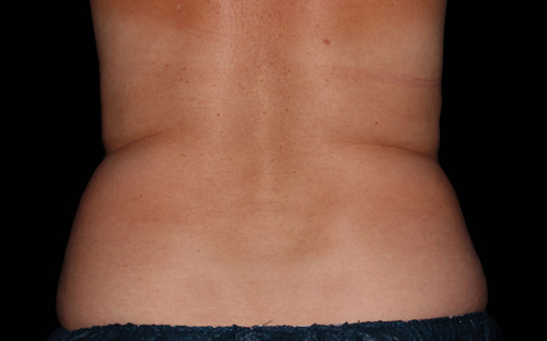 255 Before Image