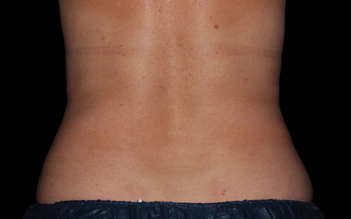 255 After Image