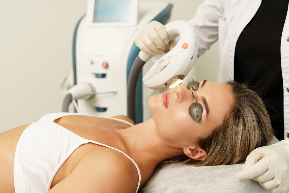 What to Expect After IPL Photofacial